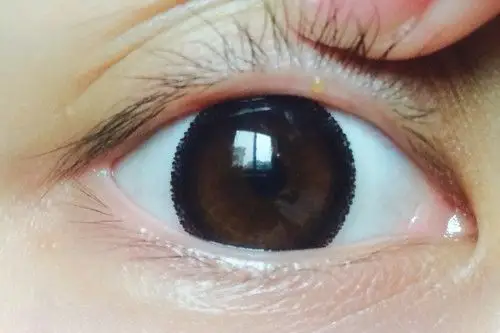 在眼皮的睫毛下方,长了一个小水泡似的东西,不痛不痒,也不难受,以前没