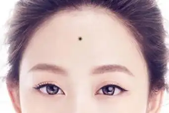有痣长在女人额头的中间位置上
