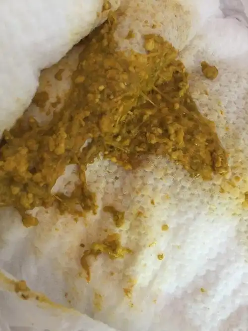 大便一直又股酸臭味!宝宝还在月子中,咋整?