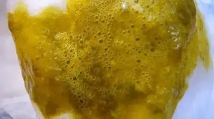 宝宝的"屎"事真多,一篇文章教你搞懂宝宝的大便