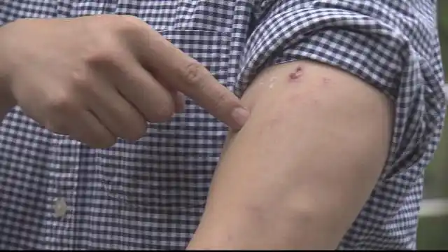 阳光威尼斯,蚊子咬到死.花百万治 or 卖房子撤?