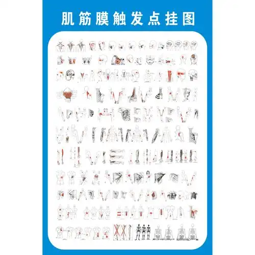 激痛点肌筋膜疼痛触发点示意图解人体肌肉解剖图解墙贴装饰画