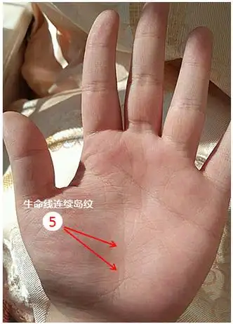 生命线线上连续出现了岛纹,中晚年运势欠佳,而且生殖泌尿功能薄弱.