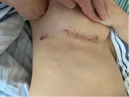 我的心脏里发出"吹风"一样的声音!