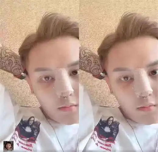 小猪先生陪韩安冉同步隆鼻,直播吐槽整容很难受,这是真爱无疑了