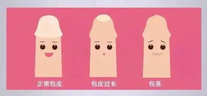 夸张!小儿包茎症状图片"出门采红莲"-第1张图片-酷虎博客