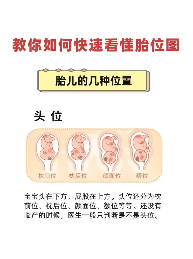 准妈妈必看 快速看懂胎位,及时纠正#内容仅供参考 #生活小 - 抖音