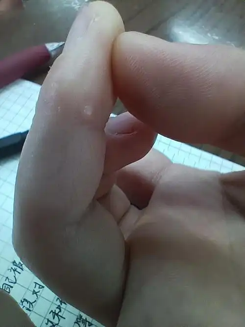 手气长得一个白色肉粒