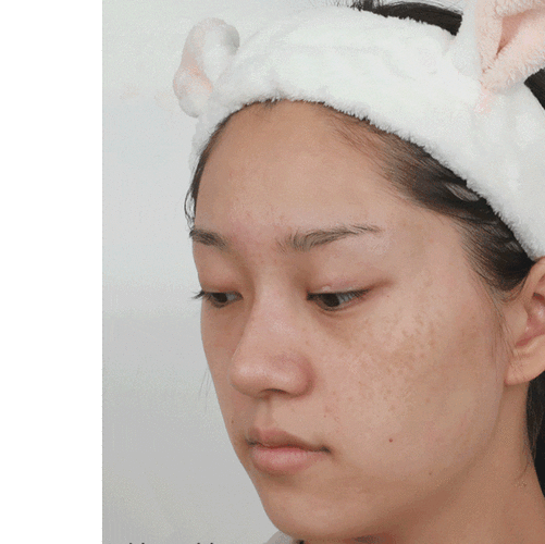 写给脸上长斑的女生