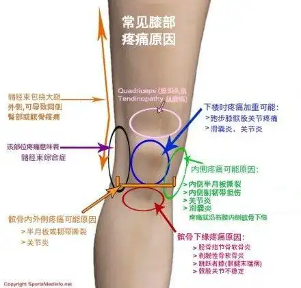 膝关节疼痛有哪些原因-----常见膝部疼痛原因 - 好大夫在线