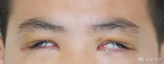 救命,原来这些"美"都是畸形病啊