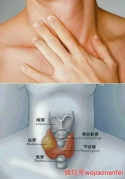 乳腺结节,甲状腺结节,淋巴结节,脂肪瘤的症状表现和治疗