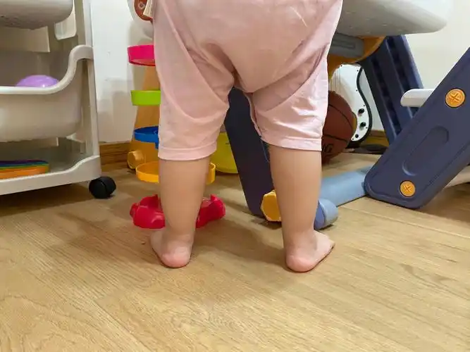 一岁半的宝宝足外翻吗
