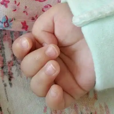 宝宝现在4个月,大拇指内扣,怎麼解决