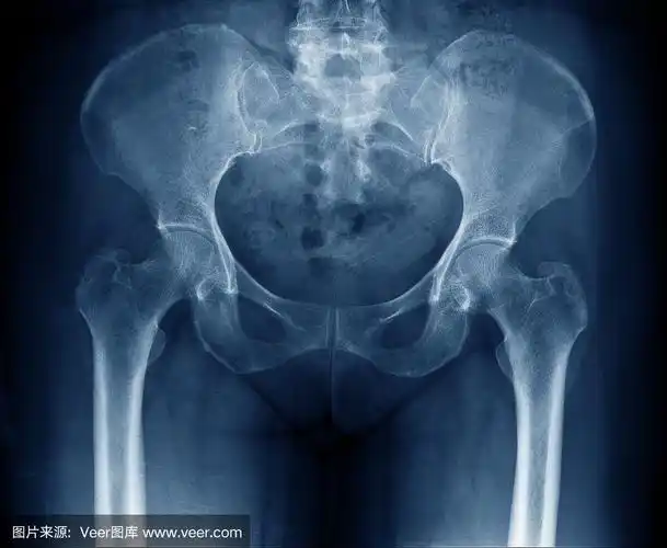 女性正常髋关节,骨盆和脊柱x线照片