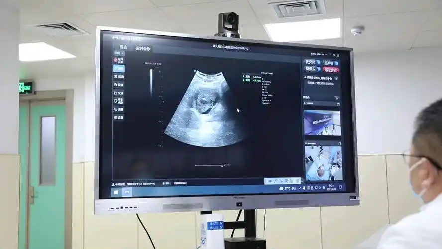 海信超声助力隔空会诊10个月检查逾300位患者