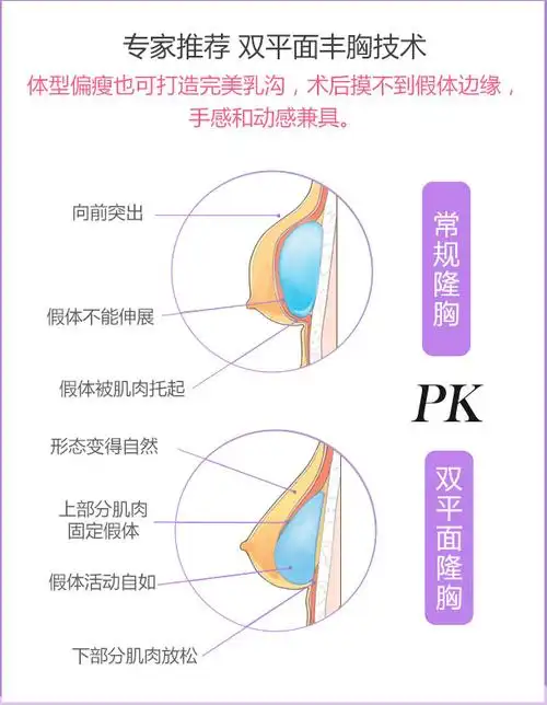 美莱深v假体丰胸