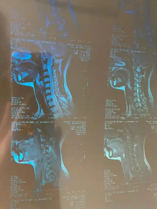 帮我看看我的颈椎