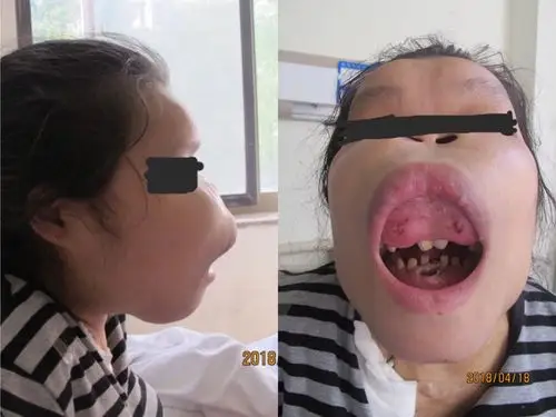 为什么说具有代表意义?是的,看到下面这张图片