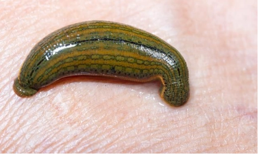 不小心把蚂蟥吃进肚子里蚂蟥真的会在人体内长期存活吗