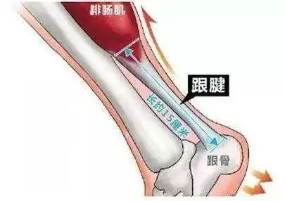 一般来说,它是因为在运动过程中,小腿腓肠肌和跟腱承受了太大的压力