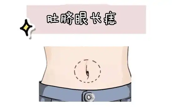 肚子有痣的位置与命运 肚子上痣的位置与命运图解