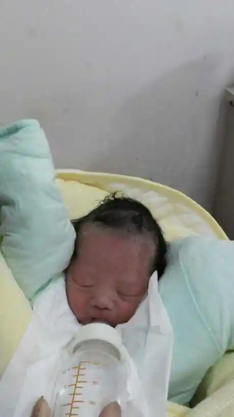 应该不是吧  你看第一张照片我宝宝左额头那里有块红红的长长的