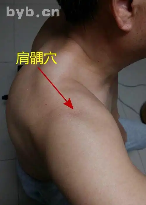 穴位的故事027肩髃肩周炎之要穴