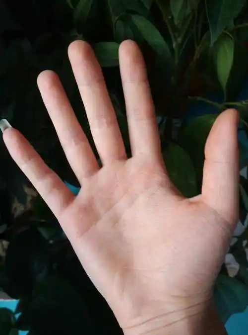 我是女生,今天发现右手小指有四节横纹, 和左手不一样耶, 怎么回事儿