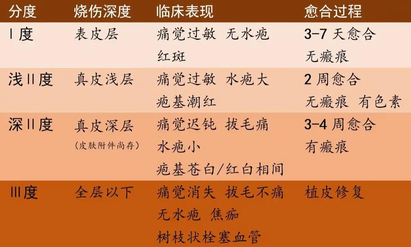 烧伤的临床表现,程度分级,补液治疗 烧伤泛指由热力(如火焰,热液,热