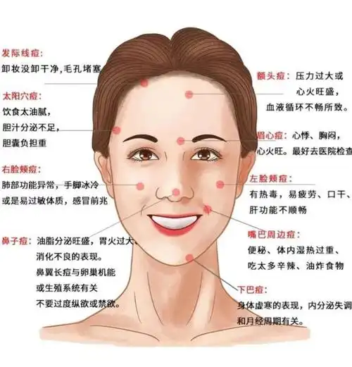 脸上不同位置长痘的原因