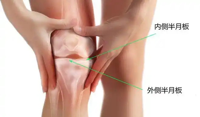无论是半月板损伤还是假性交锁,许多患者都可以通过保守治疗缓解症状