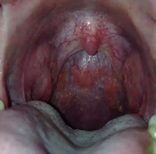 这一种野草才是最天然的抗生素可惜很多人都无视