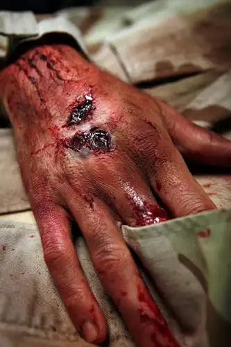 服装,军事,血,口袋,衣服,站着,手部,服饰,肮脏,暴力,衣着,穿着,受伤