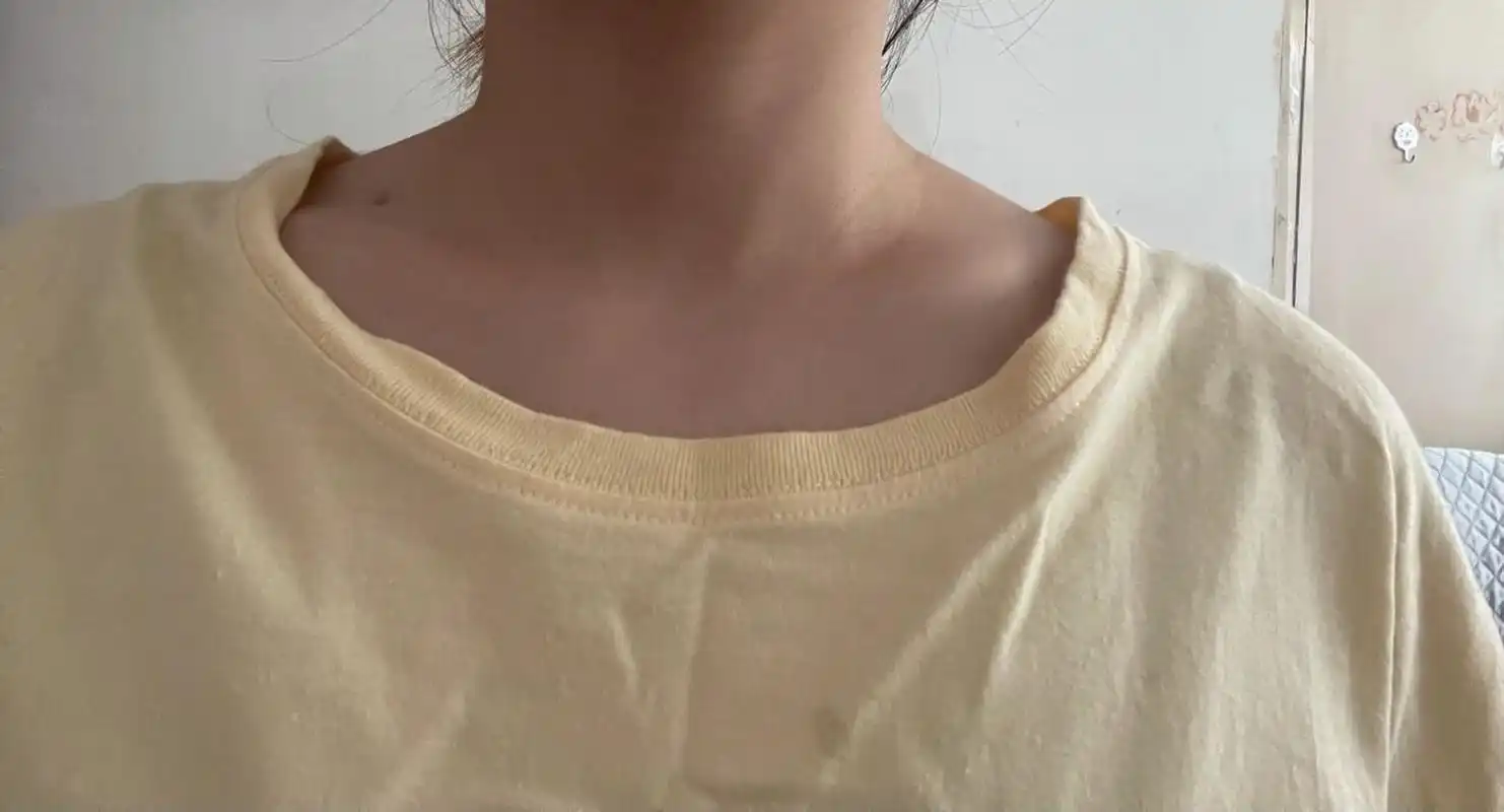 发现大家的不对称都是一边高一边低,我这个类型有点特别,锁骨这跟骨头