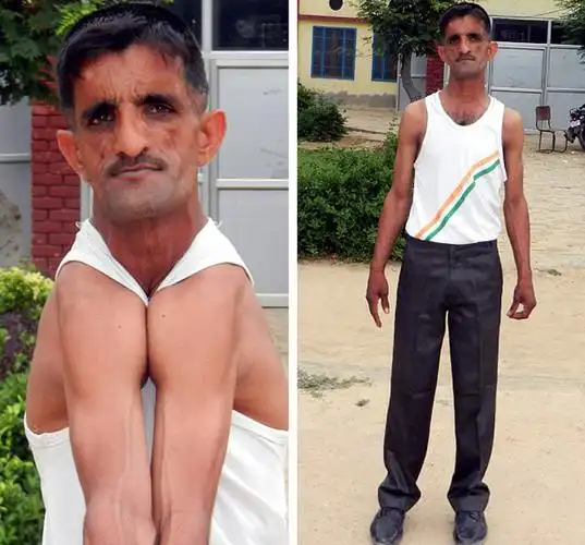 印度"橡皮人"双肩可折叠到胸前 1分钟挤碎60张cd