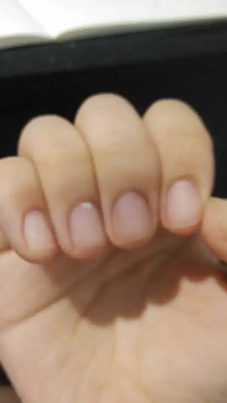 我的手指甲颜色正常吗?