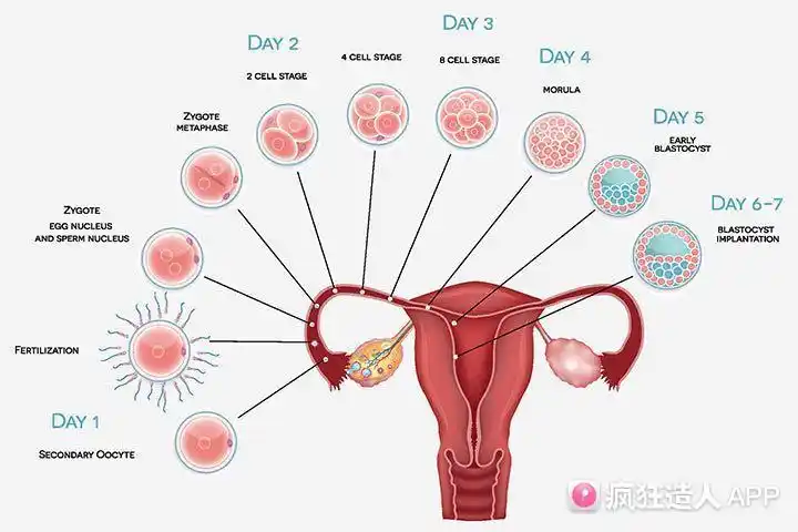 关于着床晚还是排卵晚的概念纠正