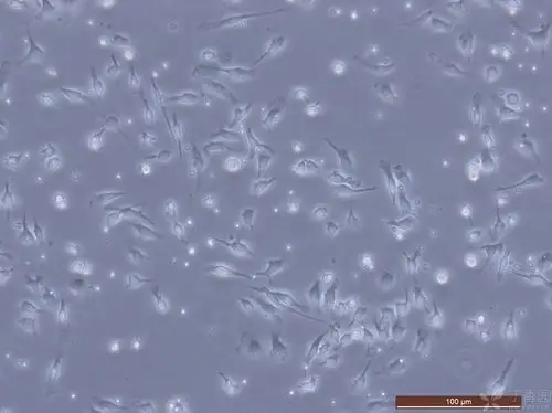 【原创】小鼠骨髓巨噬细胞原代培养技术(含图)