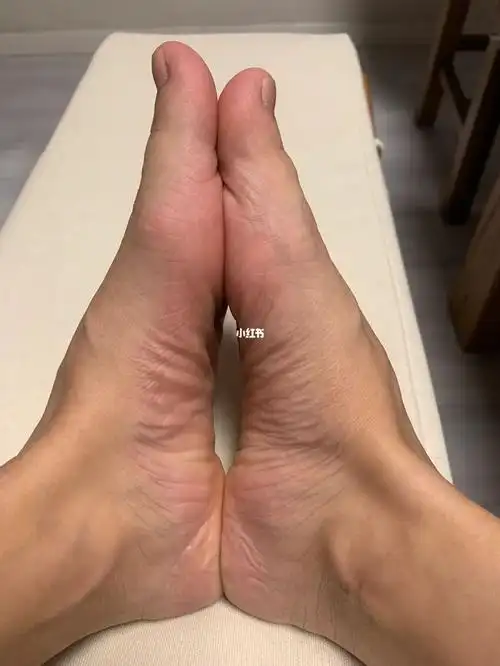 你们的大小脚也这么严重么