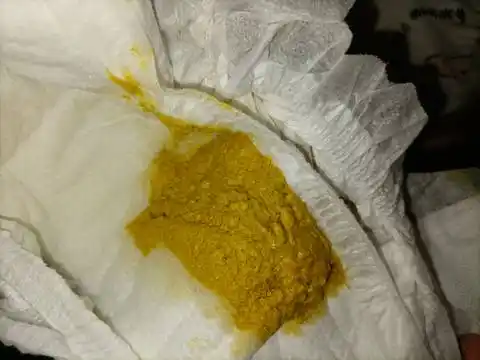 新生儿今天20天拉大便像这样是怎么回事