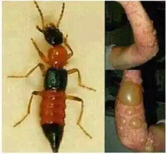 隐翅虫,又被称为 "影子虫", "青腰虫",在农田,林间,山地,河畔及海边等