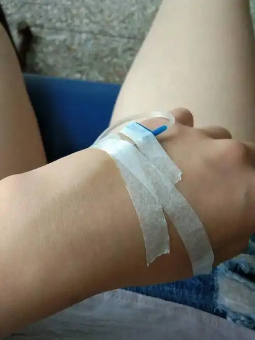 在打消炎针,但是它开始打的时候到现在一直都感有点肿,开始疼了一下