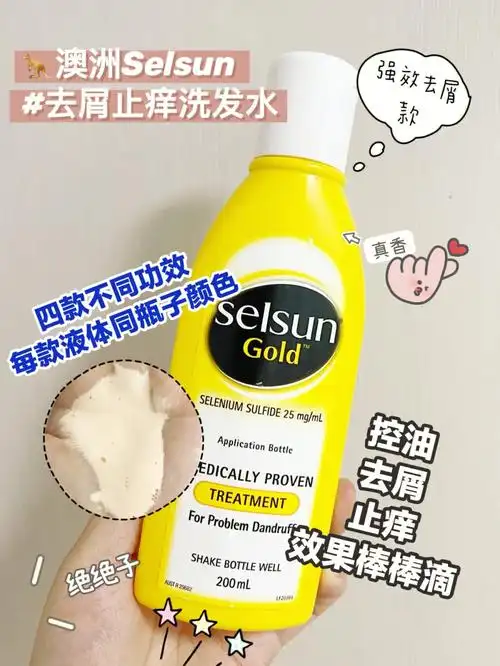 如何快速简单的去除头皮屑