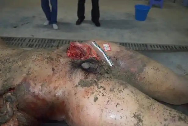 福建正扬司法鉴定所对土比子尔死因法医学鉴定