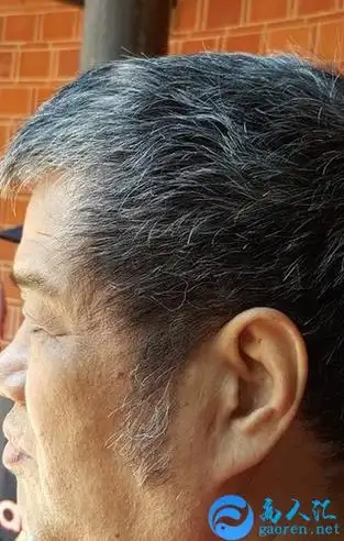 耳朵看相算命图解之没有耳垂的人面相分析