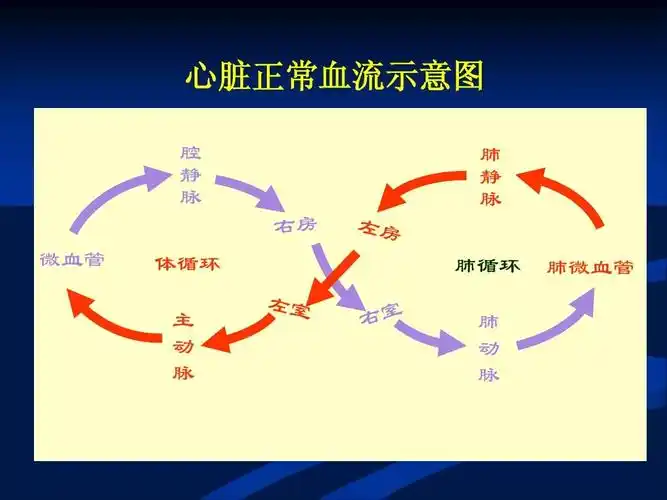 先天性心脏病vsd修改ppt