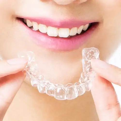 矫正维恩口腔正雅隐形牙套透明牙齿成人青少年牙齿矫正