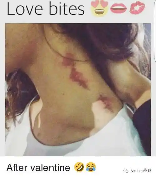 为了假装有男朋友很多女孩用吸尘器朝脖子上怼草莓