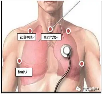 经气管插管吸痰技术(培训版)